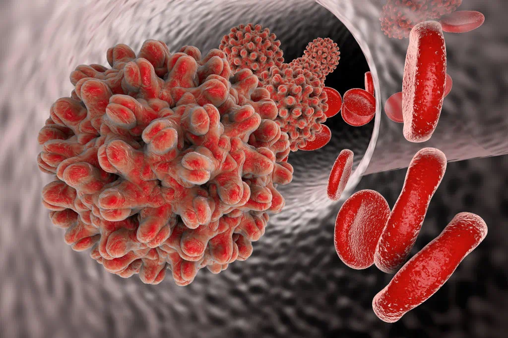 Hepatitis E: Symptoms and the Importance of Rapid IgG/IgM Testing